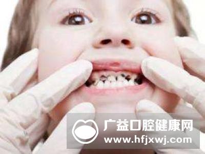 温州5岁儿童超7成患蛀牙 “吃软怕硬”让牙齿受伤
